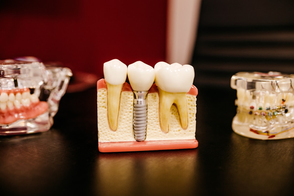 An implant model on the counter